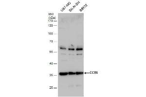 WB Image CCR5 antibody detects CCR5 protein by western blot analysis. (CCR5 antibody  (Center))
