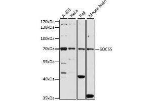 Western blot analysis of extracts of various cell lines, using SOCS5 antibody. (SOCS5 antibody)