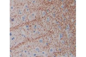 IHC-P analysis of Human Tissue, with DAB staining. (SLC1A6 antibody  (AA 156-264))