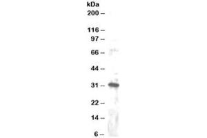 Western blot testing of Jurkat lysate with DKK4 antibody at 1ug/ml. (DKK4 antibody)
