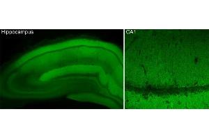 Indirect immunostaining of PFA fixed hippocampus section (dilution 1 : 500). (CACNA1B antibody  (AA 1921-2222))