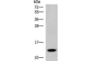 Western blot analysis of Human placenta tissue lysate using HBE1 Polyclonal Antibody at dilution of 1:300 (Hemoglobin, epsilon 1 (HBe1) antibody)