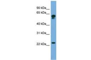 Image no. 1 for anti-Chromosome 14 Open Reading Frame 126 (C14orf126) (AA 71-120) antibody (ABIN6745654) (C14orf126 antibody  (AA 71-120))