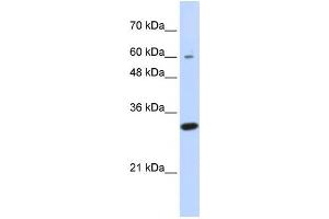 Western Blotting (WB) image for anti-Leucine Rich Repeat Containing 57 (LRRC57) antibody (ABIN2459932) (LRRC57 antibody)