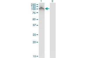 Western Blotting (WB) image for anti-Fibroblast Growth Factor Receptor 2 (FGFR2) (AA 621-723) antibody (ABIN560876)
