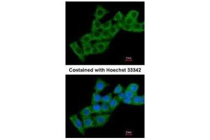ICC/IF Image Immunofluorescence analysis of methanol-fixed HepG2, using Calcium binding protein P22, antibody at 1:200 dilution.
