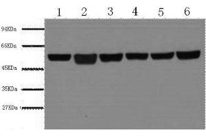 Western Blot analysis of A549, Rat brain, Mouse brain, Chicken lung, Rabbit testis, Sheep muscle using beta Tubulin Monoclonal Antibody at dilution of 1:5000. (TUBB antibody)