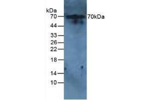 Figure. (IL-6 Receptor antibody  (AA 385-462))