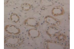 Used in DAB staining on fromalin fixed paraffin-embedded Kidney tissue (ENO1 antibody  (AA 1-434))