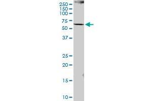 PCCB MaxPab polyclonal antibody. (PCCB antibody  (AA 1-539))