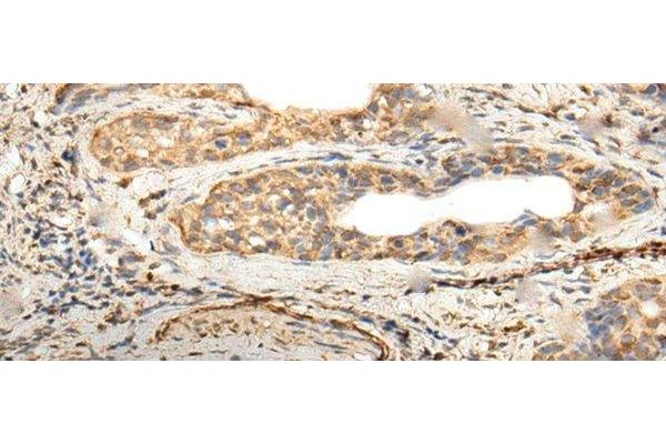ZNF8 antibody