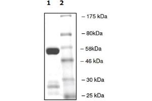 Western Blotting (WB) image for SET Domain Containing 2 (SETD2) (AA 1418-1714) (Active) protein (GST tag) (ABIN2669625)