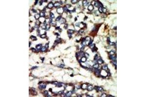 Image no. 1 for anti-NIMA-Related Kinase 1 (NEK1) (AA 1173-1202), (C-Term) antibody (ABIN360536) (NEK1 antibody  (C-Term))