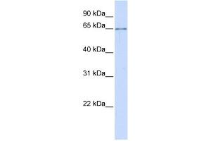 ALG6 antibody used at 1 ug/ml to detect target protein. (ALG6 antibody)