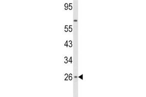 Western Blotting (WB) image for anti-Interferon, beta 1, Fibroblast (IFNB1) (AA 39-66) antibody (ABIN3028749)