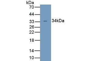 Detection of Recombinant UCP4, Human using Polyclonal Antibody to Uncoupling Protein 4, Mitochondrial (UCP4) (SLC25A27 antibody  (AA 21-317))