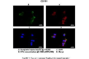 Application: IHCSpecies+tissue/cell type: Human nasal epithelial cells Primary Antibody dilution: 1:1000Secondary Antibody: Goat anti-rabbit Alexa Fluor 546 Secondary Antibody Dilution: 1:0000 (CD151 antibody  (C-Term))