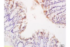 Formalin-fixed and paraffin embedded mouse small intestine labeled with Anti-TNFR1/TNF Receptor I Polyclonal Antibody, Unconjugated (ABIN682018) at 1:200 followed by conjugation to the secondary antibody and DAB staining. (TNFRSF1A antibody  (AA 1-100))