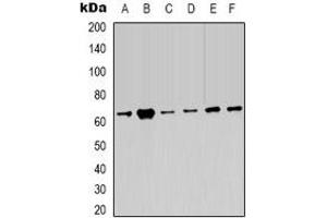 Western blot analysis of AMPK alpha 2 expression in Hela (A), 293T (B), C2C12 (C), NIH3T3 (D), rat heart (E), rat brain (F) whole cell lysates. (PRKAA2 antibody)