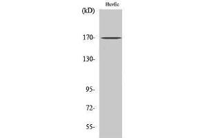 Western Blotting (WB) image for anti-SWI/SNF Related, Matrix Associated, Actin Dependent Regulator of Chromatin, Subfamily C, Member 2 (SMARCC2) (Internal Region) antibody (ABIN3183467) (SMARCC2 antibody  (Internal Region))