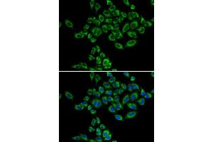 Immunofluorescence analysis of HeLa cells using SRPK1 antibody. (SRPK1 antibody)