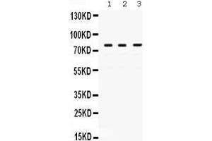 Western Blotting (WB) image for anti-Polymerase (DNA Directed), eta (POLH) (AA 157-361) antibody (ABIN3042492) (POLH antibody  (AA 157-361))