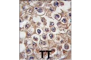 Formalin-fixed and paraffin-embedded human testis tissue reacted with INSRR antibody (N-term), which was peroxidase-conjugated to the secondary antibody, followed by DAB staining. (Insulin Receptor antibody  (N-Term))