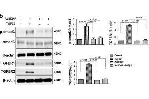 Western Blotting (WB) image for anti-SMAD, Mothers Against DPP Homolog 3 (SMAD3) (pSer423), (pSer425) antibody (ABIN129675)