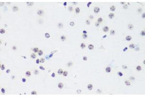 Immunohistochemistry of paraffin-embedded Mouse brain using TriMethyl-Histone H3-K64 Polyclonal Antibody at dilution of 1:100 (40x lens). (Histone 3 antibody  (3meLys64))