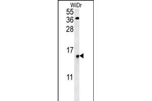 C19orf50 Antikörper  (AA 59-85)