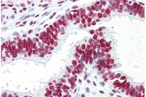 Human Uterus (Formalin-Fized, Paraffin-Embedded) stained with ACIN1 antibody ABIN461879 at 5 ug/ml followed by biotinylated goat anti-rabbit IgG secondary antibody ABIN481713, alkaline phosphatase-streptavidin and chromogen.