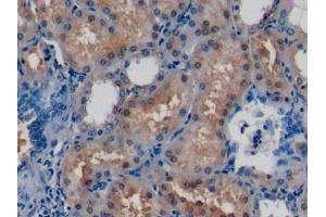 Detection of DUSP3 in Human Kidney Tissue using Polyclonal Antibody to Dual Specificity Phosphatase 3 (DUSP3) (Dual Specificity Phosphatase 3 (DUSP3) (AA 2-185) antibody)