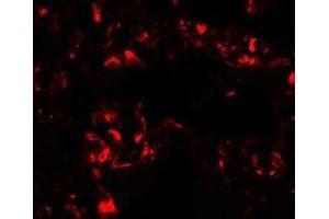 Immunofluorescence of FOXRED2 in human lung cells with FOXRED2 antibody at 20 ug/mL. (FOXRED2 antibody  (N-Term))
