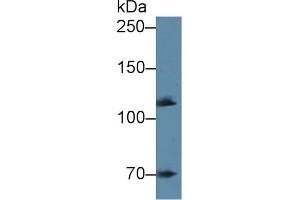 Detection of ADD1 in Mouse Cerebrum lysate using Polyclonal Antibody to Alpha Adducin (ADD1) (alpha Adducin antibody  (AA 388-560))