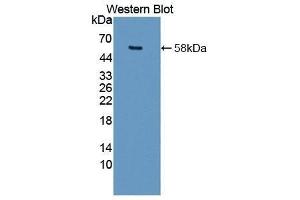 Western Blotting (WB) image for anti-Matrix Metallopeptidase 15 (Membrane-inserted) (MMP15) (AA 280-497) antibody (ABIN1862908)
