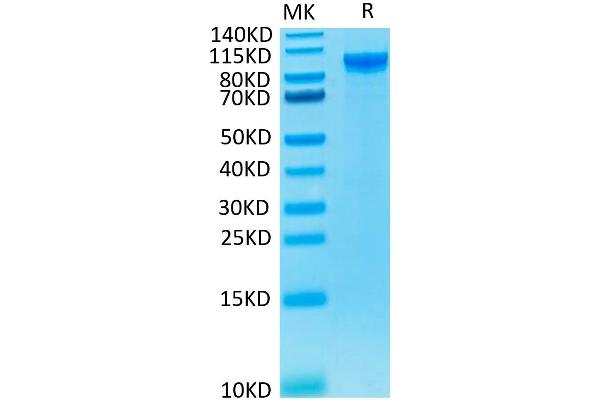 ENPP2 Protein (His tag)