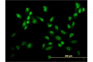 Immunofluorescence of monoclonal antibody to USF2 on HeLa cell. (USF2 antibody  (AA 1-100))