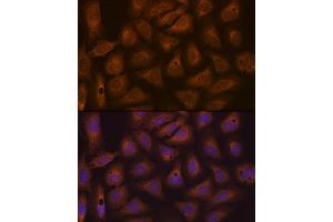 Immunofluorescence analysis of U-2 OS cells using CAD Rabbit mAb (ABIN7266064) at dilution of 1:100 (40x lens). (CAD antibody)