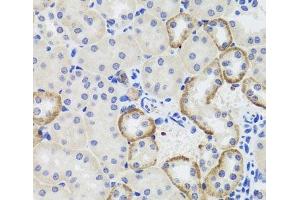 Immunohistochemistry of paraffin-embedded Mouse kidney using MTERFD3 Polyclonal Antibody at dilution of 1:100 (40x lens). (MTERFD3 antibody)