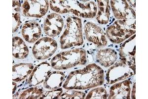 Immunohistochemical staining of paraffin-embedded prostate tissue using anti-RC201933 mouse monoclonal antibody. (PIM2 antibody)