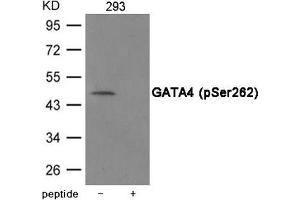 Western blot analysis of extracts from 293 cells using GATA4 (Phospho-Ser262) Antibody. (GATA4 antibody  (pSer262))