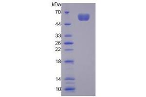 Image no. 1 for NUAK Family, SNF1-Like Kinase, 1 (NUAK1) (AA 404-651) protein (His tag,GST tag) (ABIN6238335) (NUAK1 Protein (AA 404-651) (His tag,GST tag))