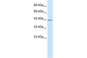 Western Blotting (WB) image for anti-IKAROS Family Zinc Finger 2 (IKZF2) antibody (ABIN2460270)