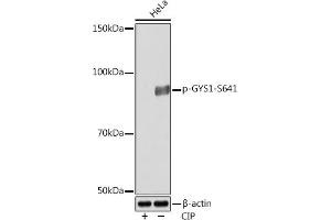 Western blot analysis of extracts of various cell lines, using Phospho-GYS1-S641 Rabbit mAb (ABIN7270761) at 1:1000 dilution. (Glycogen Synthase 1 antibody  (pSer641))