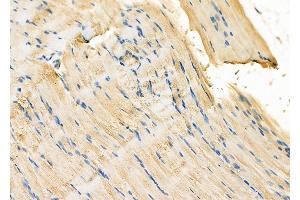 ABIN6260384 and ABIN6278087 at 1/100 staining Rat muscle tissue by IHC-P. (CAB39 antibody  (C-Term))