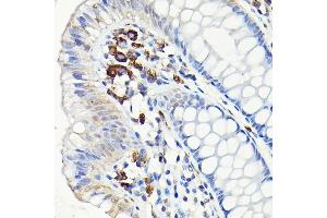 Immunohistochemistry of paraffin-embedded human colon using CD68 Rabbit pAb (ABIN6132070, ABIN6138218, ABIN6138221 and ABIN6217224) at dilution of 1:50 (40x lens). (CD68 antibody  (AA 22-319))