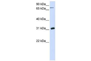 Western Blotting (WB) image for anti-Uridine Phosphorylase 1 (UPP1) antibody (ABIN2458626) (UPP1 antibody)