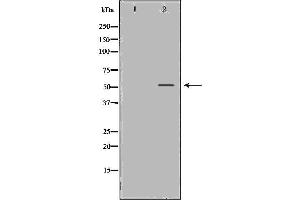 Western blot analysis of LoVo cell lysate, using MMP13 Antibody. (MMP13 antibody  (N-Term))