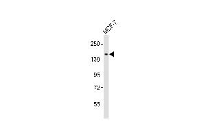 Anti-NACAD Antibody at 1:1000 dilution + MCF-7 whole cell lysates Lysates/proteins at 20 μg per lane.