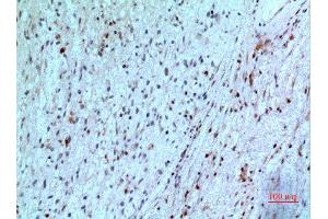 Immunohistochemistry (IHC) analysis of paraffin-embedded Human Brain, antibody was diluted at 1:100. (Thymidine Phosphorylase antibody  (N-Term))